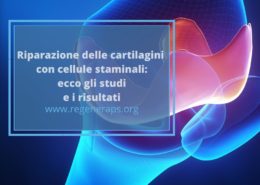 riparazione cartilagini con staminali copertina